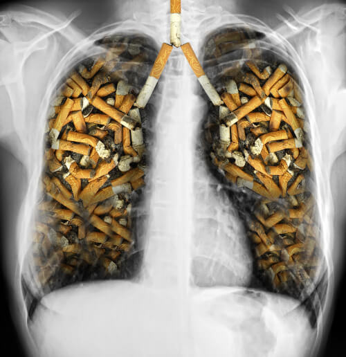 Sigara ve Ciğerler